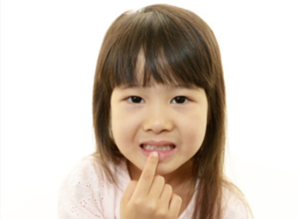 過剰歯の抜歯も行っています